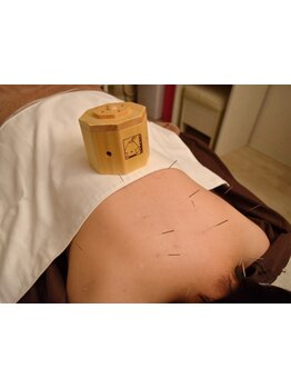 鍼灸施術を受けたい