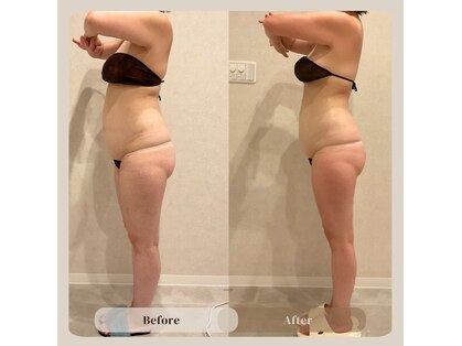 サンスエイジ(Sans age)の写真