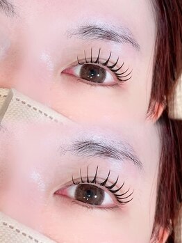 アテプラス(ate+)/アンドヘルシー