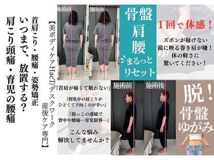 ハクト(HacT)の写真