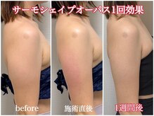 フェムプリュ(femplus)の雰囲気（＼夏までに完成／ほっそり二の腕でノースリーブも怖くない！！）