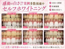 メルヴェイユ