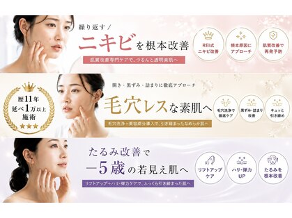 レイ(REI)の写真