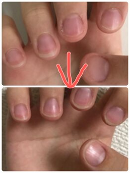 エンヴィ(ENVY)/自爪育成