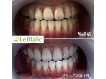 ルブラン 奈良店(Le Blanc)/お得なフリーパスコース