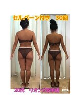 リオンズ 茨城ミスターマックス取手店/セルバーン付き　30回　20代女性