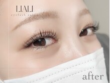 リアリ 市川(LIALI)/デザインキープラッシュ100束