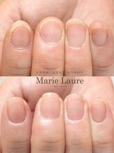マリーロール 梅田店(Marie Laure)/深爪矯正/自爪育成/自爪風