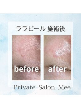 ミー(Mee)/女性にも☆男性にもおすすめ