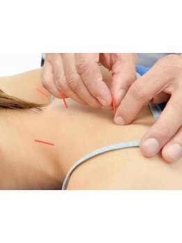 首・肩のつらさを改善したい