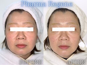 レイネ(REINE)/ファーマリジェネ/美肌三大要素