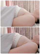 エル(eL)/ガウンから溢れてしまう