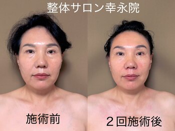 幸永院 川口店/【小顔】最短で結果を求める方へ