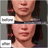 エルアンドエス(L&S)