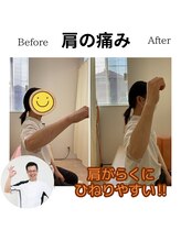 三条かがやき整体院/肩の痛み改善