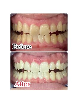 ホワイトニングスタイル 柏店/別人級ホワイトニング