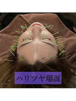 ルディア 堂島店(ledia)/大阪美容鍼でハリツヤ