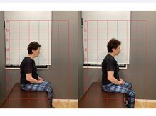 摂津本山駅前鍼灸整骨院/ビフォーアフターになります！