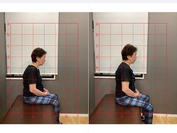 摂津本山駅前鍼灸整骨院/ビフォーアフターになります！