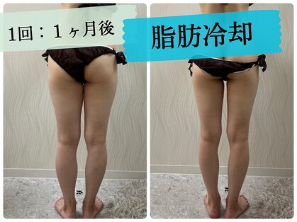ソルニス(Solnis.)の写真