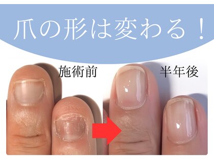 リング ザ ベル(ring the bell)の写真