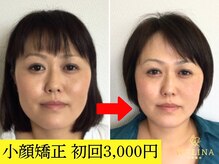 美容整体ウェリナ 名駅院