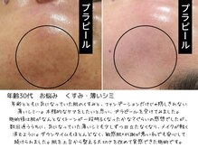 パルテール/お顔のくすみがお悩み【口コミ】