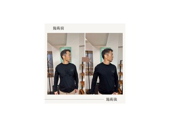 バレルメディカル研究所 恵比寿/首が回りだす。