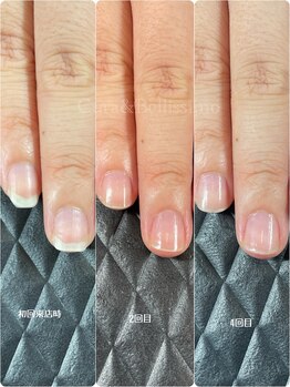 クーラ アンド ベリッシモ(Cura&Bellissimo)/