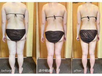 アンドワイ バイ サロンリーナ(&y by Salon Lena)/【深層汗腺リンパマッサージ】