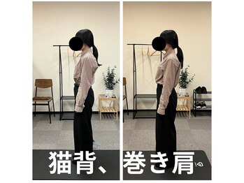カワル整体 長嶺院/猫背、巻き肩