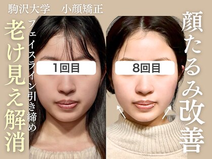 フレキシボディ(FlexiBody)の写真