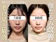 フレキシボディ(FlexiBody)の写真