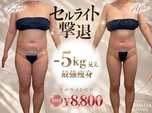 リモアボーテ(RIMOA beaute)