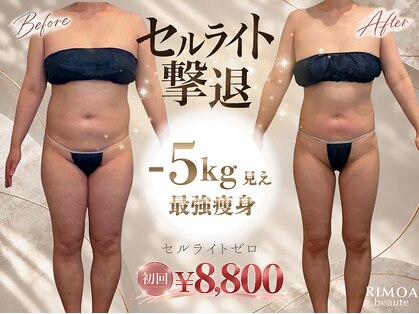 リモアボーテ(RIMOA beaute)の写真