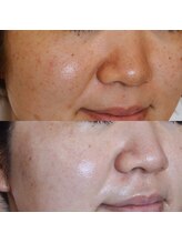 エトル(etole)/30代前半お客様症例写真