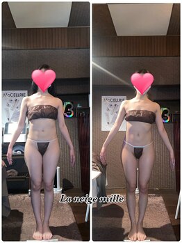 ラネージュミル(La neige mille)/インキュア痩身