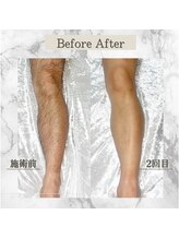 フォー(the 4)/before &nbsp;&nbsp;&nbsp;after