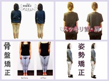練馬アカデミア美容整体院/姿勢　骨盤矯正　美容整体　整体