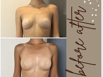 モア(moa)の写真