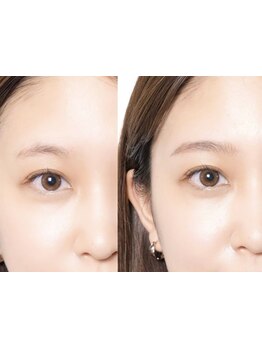 アイブロウメニューがあるサロン