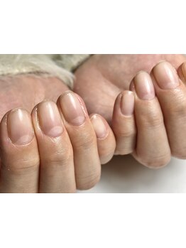 爪の悩みを解消できる（ケア含む）