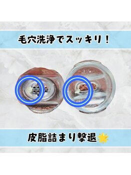 ビメンズ(BiMen's)/頑固な毛穴詰まりもスッキリ♪