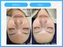 トウメイコガオ 横浜店/トウメイコガオ【ララピール】