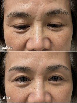 ミオ(Mio)の写真/【-5歳の印象へ】門戸厄神の大人女性の理想を叶える♪自然で若々しく、品のある目元で毎日を輝かせます◎