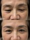ミオ(Mio)の写真/【-5歳の印象へ】門戸厄神の大人女性の理想を叶える♪自然で若々しく、品のある目元で毎日を輝かせます◎