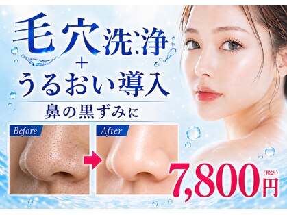 レフアの写真