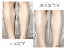 エイシー(ACEY)/ビフォーアフター☆全脚