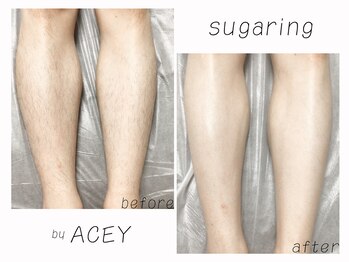 エイシー(ACEY)/ビフォーアフター☆全脚