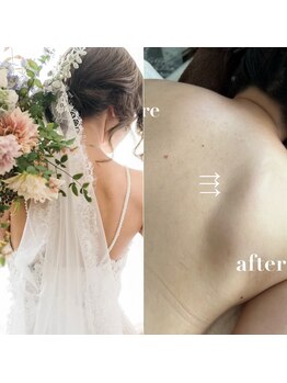セリジェ 青山(Cerisier)/ブライダルボディも☆挙式まで☆